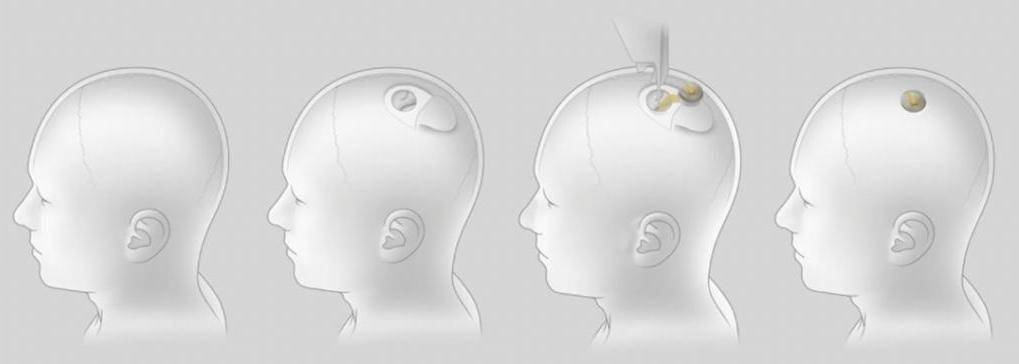 马斯克公司回应残忍虐猴，动物实验什么时候是个头？插图3