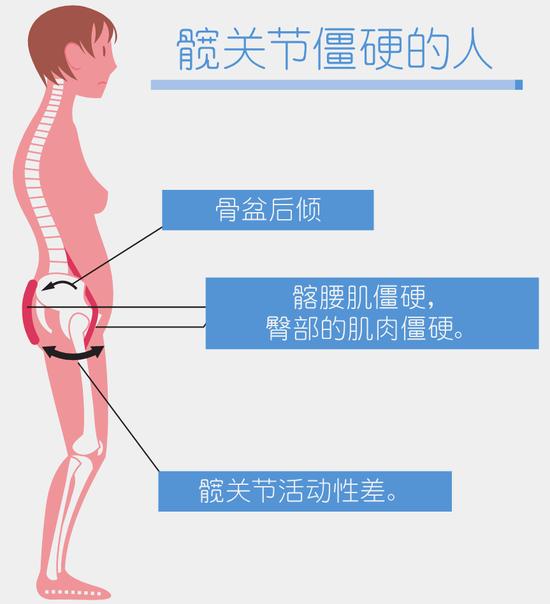 驼背老态是因为髋关节僵硬 睡前5分钟瑜伽改善体态插图5