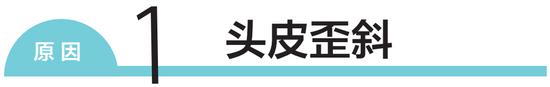 解决毛发弯曲和松软发质 按摩头皮+重视油分护理插图3