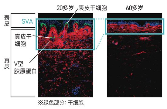 年龄增长和紫外线损伤肌肤 教你如何预防深层皱纹插图6