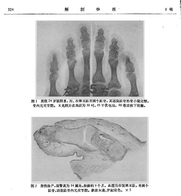 人体共有206块骨头 为啥中国人却普遍只有204块插图2