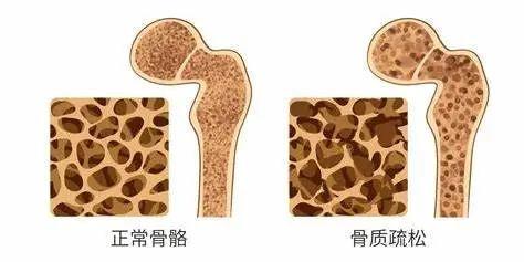 骨相美人更耐老 抗老秘诀在于多补钙插图5